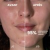 lotion anti imperfections